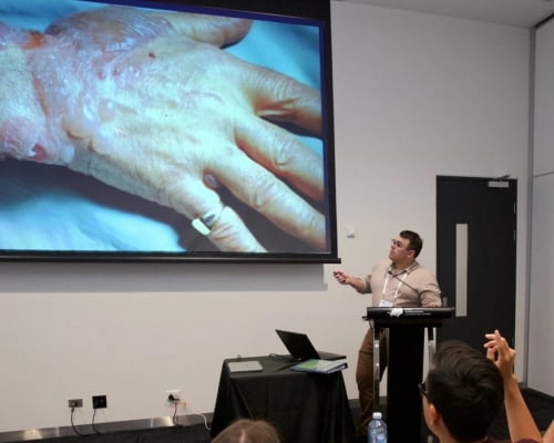 Doctors discussing a skin condition on a hand