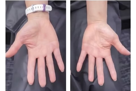 4 weeks follow up