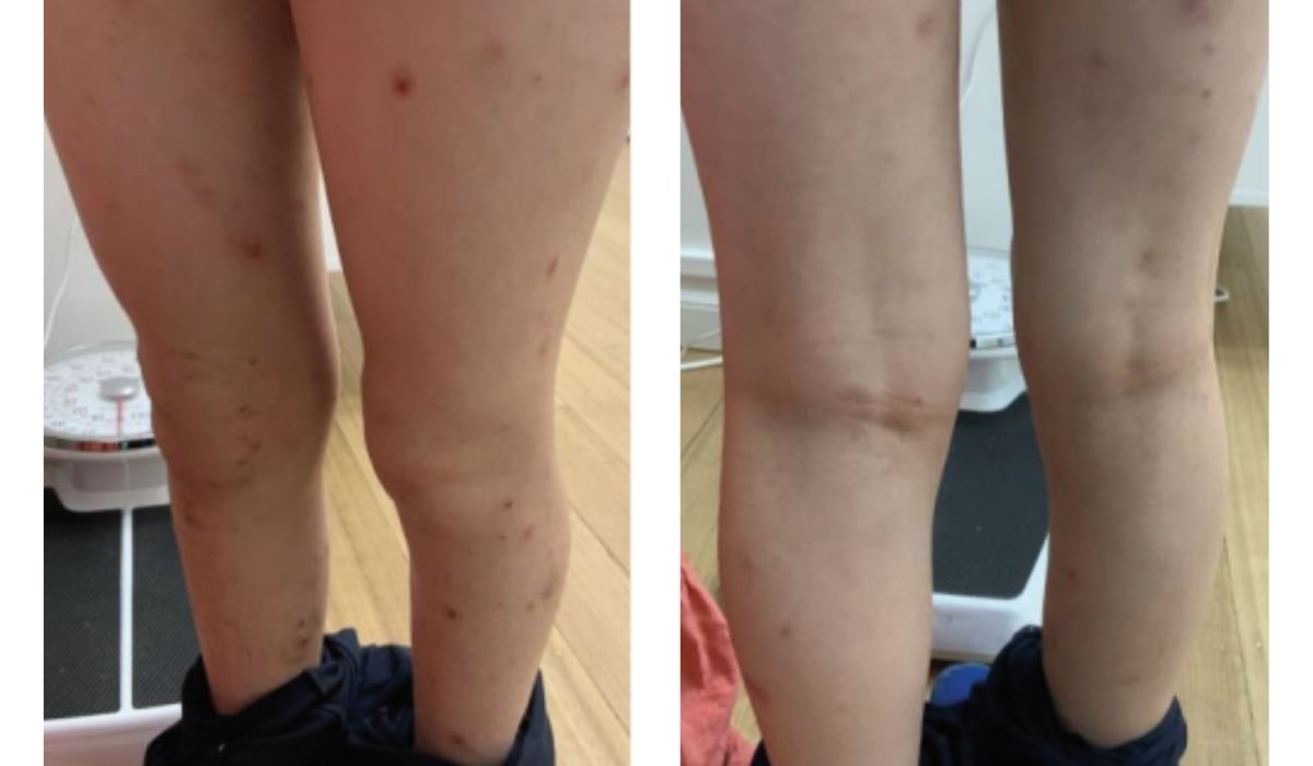 general dermatology case discussion