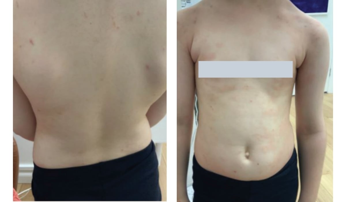 general dermatology case discussion