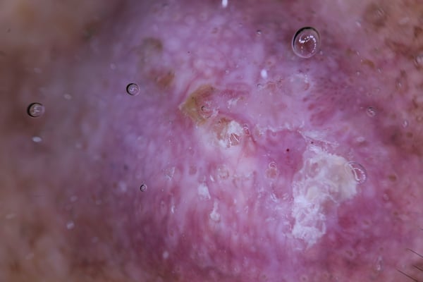 87d92224-70a2-4810-9692-0496d5e4733b-case_photos-JB