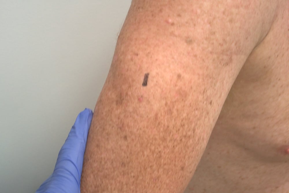 Arm Macro-1