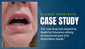dermatology case study