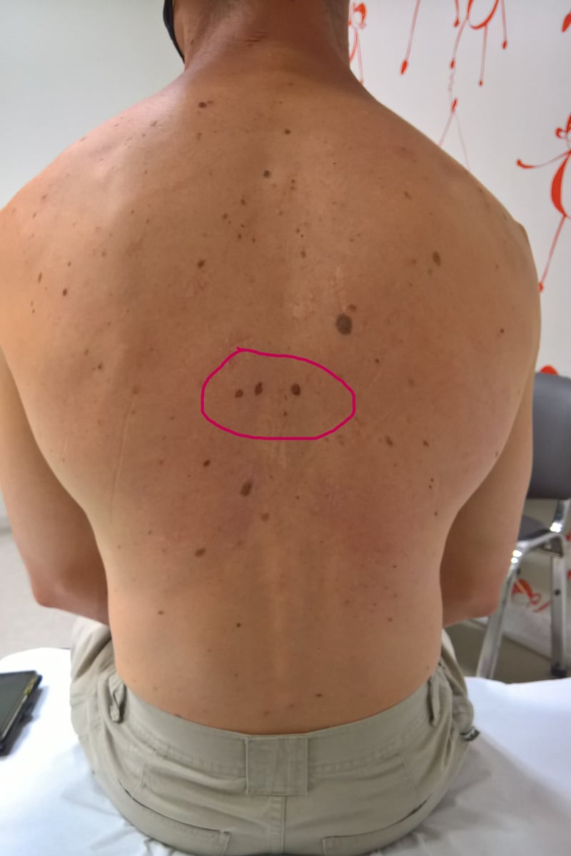 Back