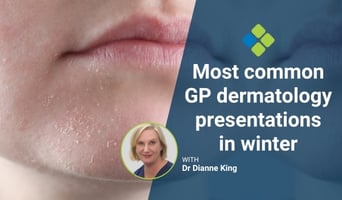 winter skin concerns