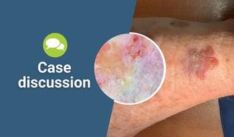 case discussion