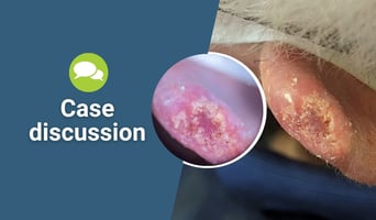 case discussion