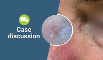 case discussion