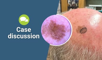 case discussion