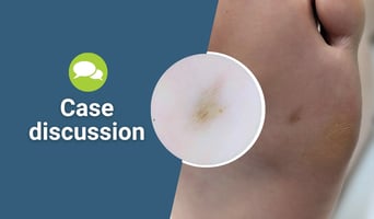 case discussion