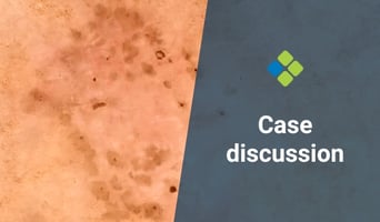 case discussion
