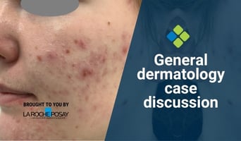 dermatology case discussion