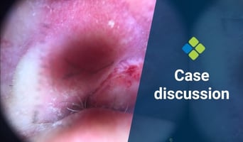 case discussion
