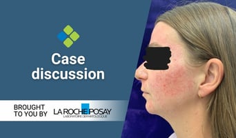 case discussion