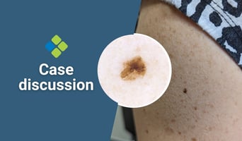case discussion