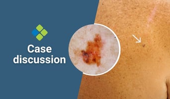 case discussion
