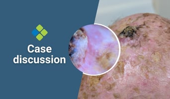 case discussion