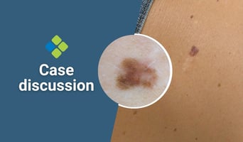 case discussion