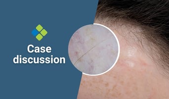 case discussion