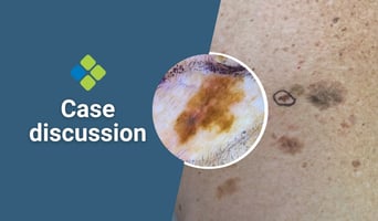 case discussion