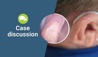 case discussion