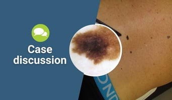 case discussion