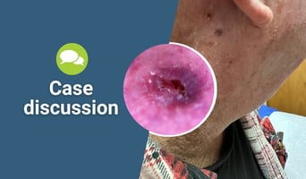 case discussion