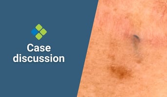 case discussion