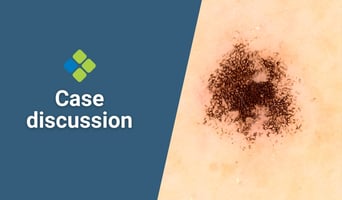 case discussion