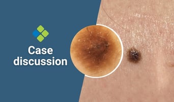 case discussion