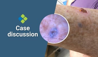case discussion