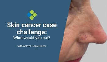 skin cancer case challenge