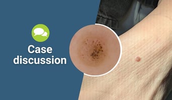 case discussion