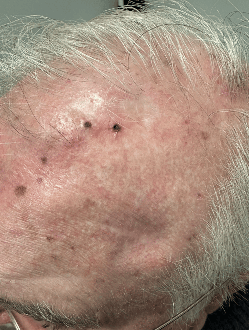 Clinical image-2