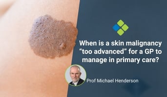 when is skin cancer too advanced?