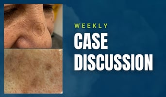 case discussion
