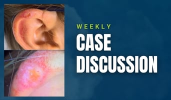 case discussion