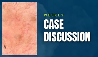 case discussion
