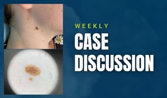 case discussion