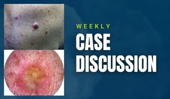 case discussion