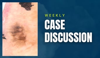 case discussion