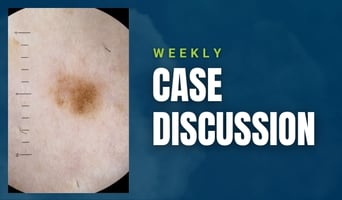 case discussion