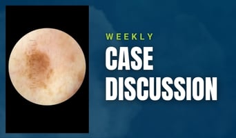 case discussion