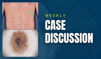 case discussion