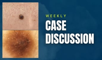case discussion