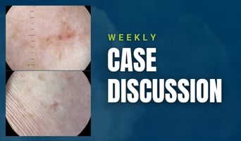 case discussion