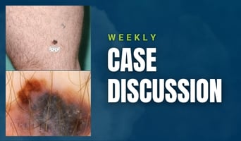 case discussion