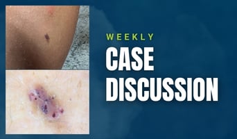 case discussion