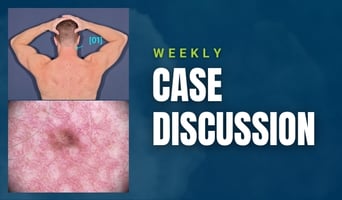 case discussion