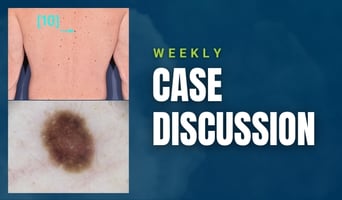 case discussion